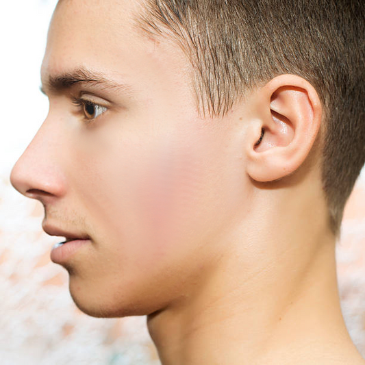 Miracle Acne Cream Removes Spots Within 24hours!